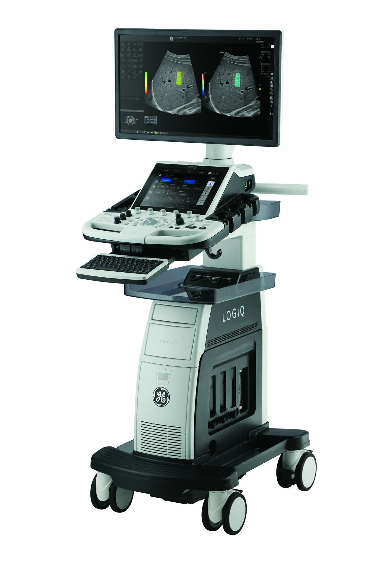 GE HealthCare LOGIQ P10