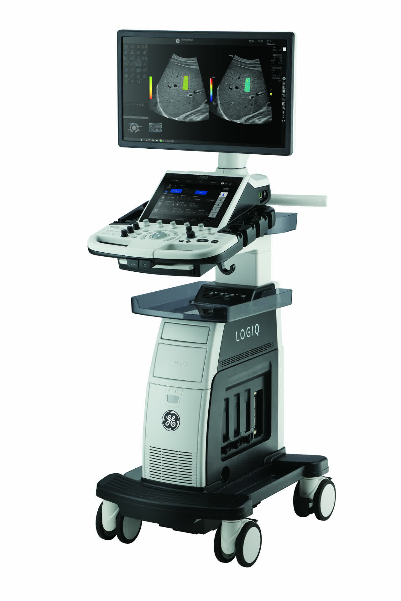 GE HealthCare LOGIQ P9