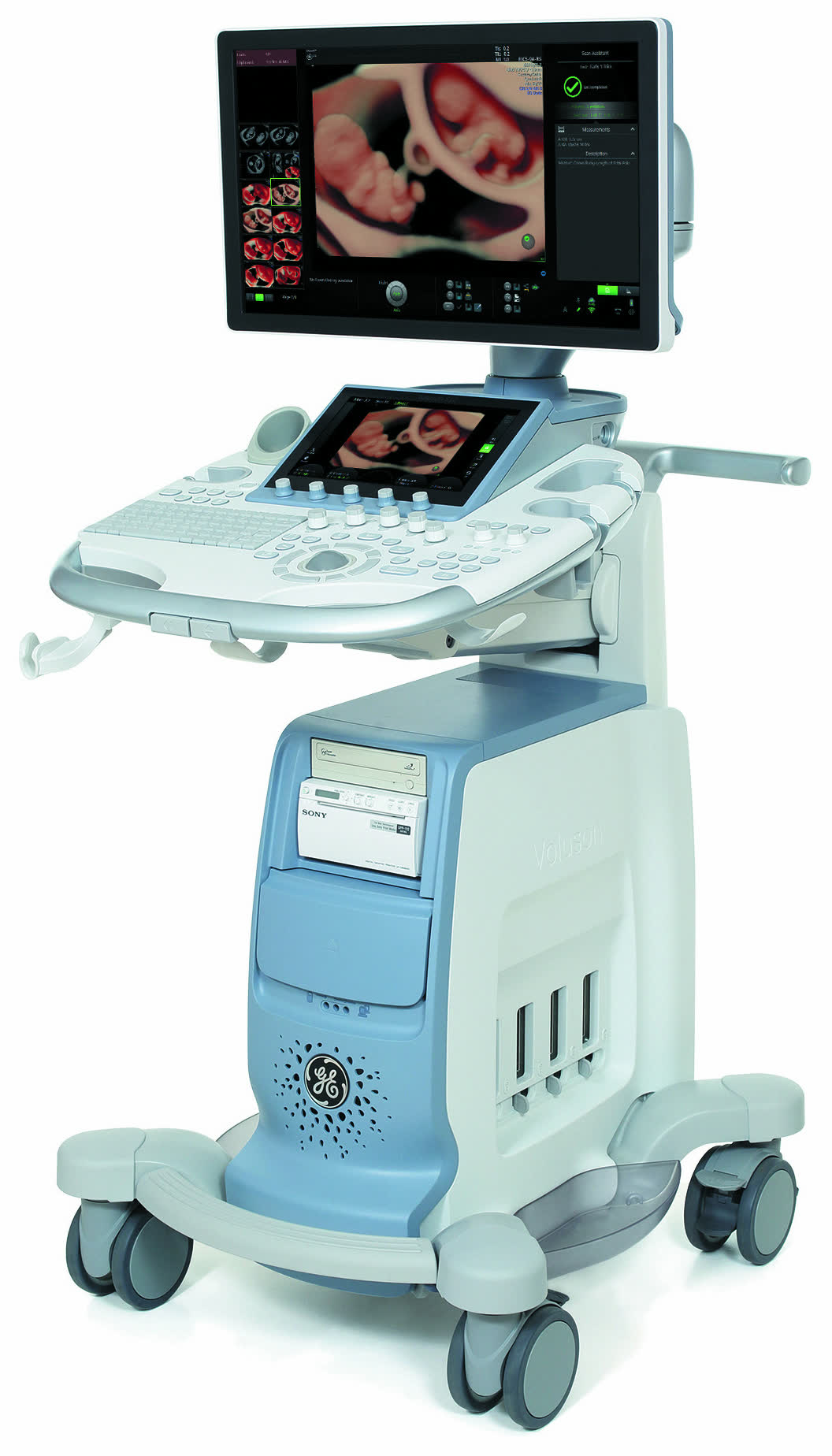 GE HealthCare Voluson S10